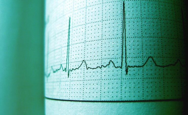 track call history 9196662230