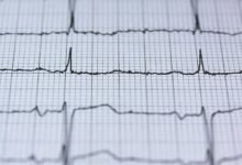 luminous growth node pulse